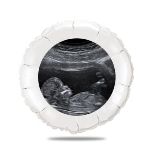 Ballon personnalisé gender reveal - echographie