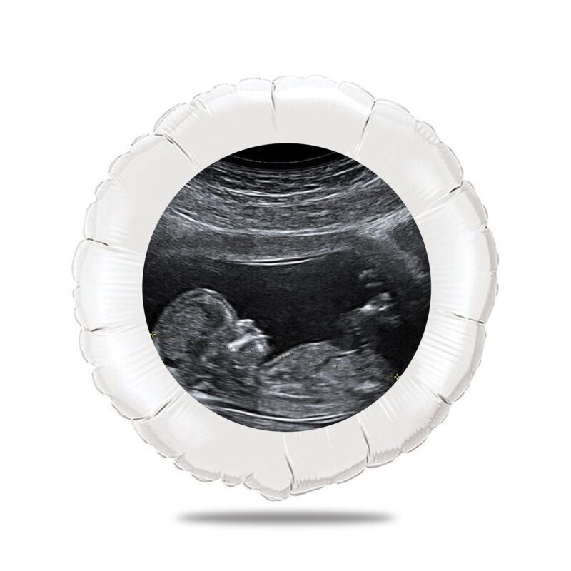 Ballon personnalisé gender reveal - echographie